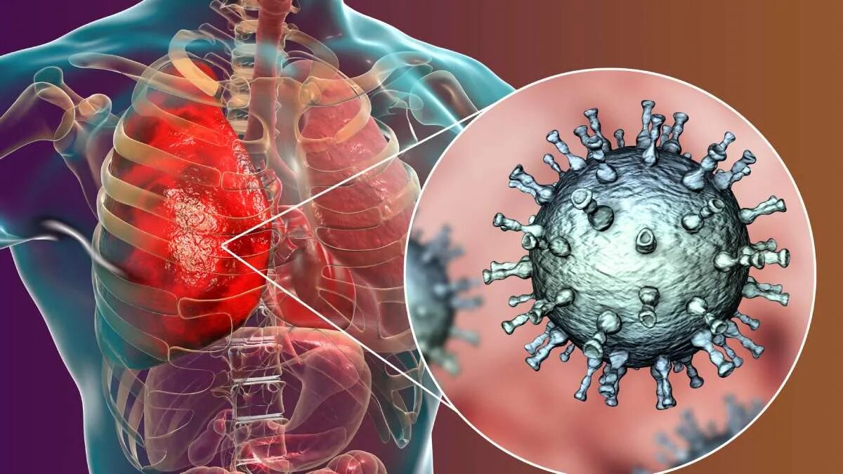 ¿Es peligroso el virus (HMPV) que ha desatado la alarma en China?